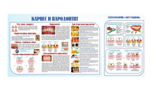 Стенд кариес и пародонтит [CDR]