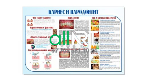 Стоматологияға кариес және периодонтит бойынша таныстыру стенді / Ознакомительный стенд по кариесу и пародонтиту в стоматологию [CDR]